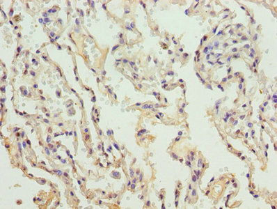 CSB-PA005743LA01HU